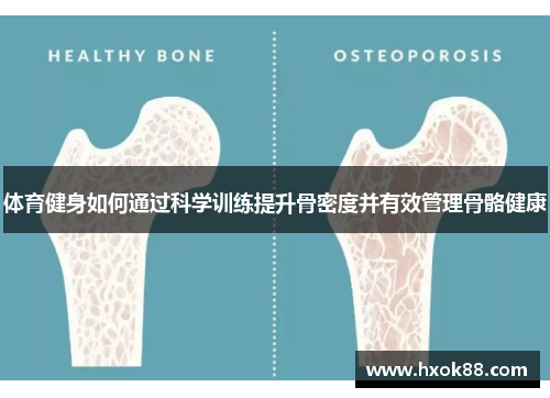 体育健身如何通过科学训练提升骨密度并有效管理骨骼健康
